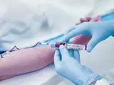 Rivoluzionare l'assistenza ai pazienti con i test point of care (POCT)