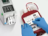 Was sind die richtigen RFID-Tags für Patientenarmbänder und Blutbeutel-Etiketten? UHF oder HF?